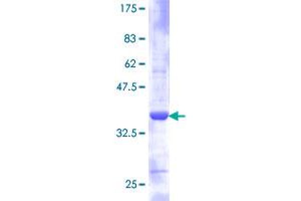 RPS21 Protein (AA 1-81) (GST tag)