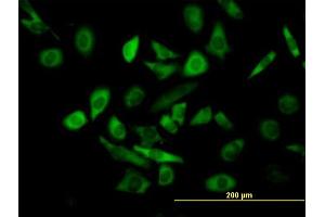 Immunofluorescence of purified MaxPab antibody to TRIM25 on HeLa cell. (TRIM25 antibody  (AA 1-630))
