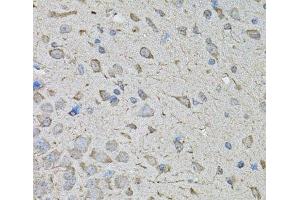 Immunohistochemistry of paraffin-embedded Mouse brain using CDK10 Polyclonal Antibody at dilution of 1:100 (40x lens). (CDK10 antibody)