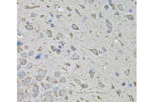 Immunohistochemistry of paraffin-embedded Mouse brain using CDK10 Polyclonal Antibody at dilution of 1:100 (40x lens).