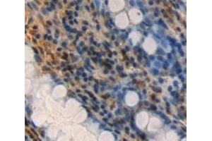 Used in DAB staining on fromalin fixed paraffin-embedded rectum tissue (FAM3D antibody  (AA 26-224))