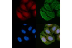 ABIN6256272 and ABIN6274032 staining Hela cells(45 min of heat-shock) by IF/ICC.