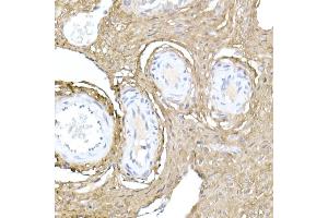 Immunohistochemistry of paraffin-embedded rat ovary using Collagen I/COL1 Rabbit pAb (352) at dilution of 1:150 (40x lens).