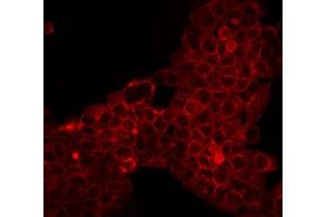 Dylight 549 Goat Anti Mouse IgG antibody-Immunofluorescence  Dylight 549 Goat Anti Mouse IgG antibody-Immunofluorescence Cell Type: A431 cells Fixation: 4% paraformaldehyde 10 min Permeablization: 0. (Goat anti-Mouse IgG Antibody (DyLight 549) - Preadsorbed)