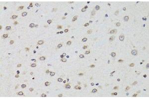 Immunohistochemistry of paraffin-embedded Mouse brain using TMPO Polyclonal Antibody at dilution of 1:100 (40x lens). (Thymopoietin antibody)