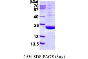 SDS-PAGE (SDS) image for Dual Specificity Phosphatase 21 (DUSP21) (AA 1-190) protein (His tag) (ABIN668019) (DUSP21 Protein (AA 1-190) (His tag))