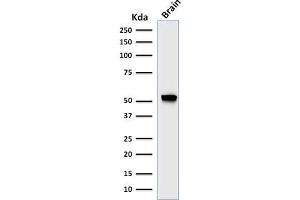 Western Blot Analysis of human brain tissue lysate using GFAP Mouse Recombinant Monoclonal Antibody (rASTRO/789). (Recombinant GFAP antibody)