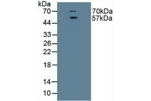 Detection of EAAT3 in Rat Brain Tissue using Polyclonal Antibody to Excitatory Amino Acid Transporter 3 (EAAT3) (SLC1A1 antibody  (AA 115-209))