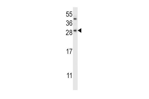 CHMP2B antibody  (N-Term)