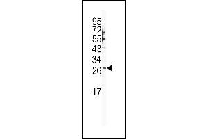 Western blot analysis of SNAI1 Antibody (N-term R8) (ABIN388810 and ABIN2839128) in NCI- cell line lysates (35 μg/lane). (SNAIL antibody  (N-Term))