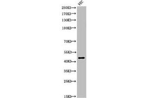 Western Blot analysis of VEC cells using Cleaved-Plasma Kallikrein HC (R390) Polyclonal Antibody (KLKB1 antibody  (Cleaved-Arg390))