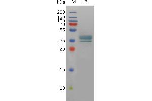 PTGER2 Protein (AA 1-23) (Fc Tag)