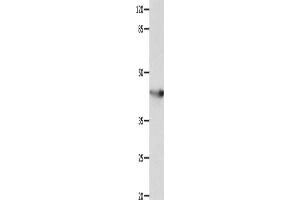 Western Blotting (WB) image for anti-Potassium Voltage-Gated Channel, Shaker-Related Subfamily, Member 5 (KCNA5) antibody (ABIN2428318) (KCNA5 antibody)