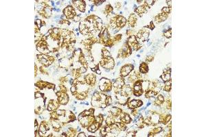 Immunohistochemistry of paraffin-embedded human stomach using S1/PR antibody (ABIN6129890, ABIN6136741, ABIN6136742 and ABIN6221835) at dilution of 1:200 (40x lens). (PRAS40 antibody  (AA 152-276))