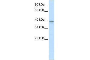WB Suggested Anti-NEUROD6 Antibody Titration:  0. (NEUROD6 antibody  (N-Term))