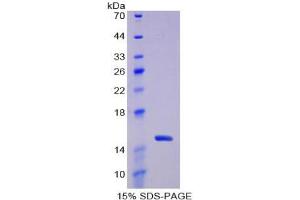 SDS-PAGE analysis of Rat Thioredoxin Protein. (TXN Protein)