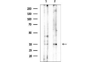 anti-Olfactory Receptor 1E5 (OR1E1) (C-Term) antibody