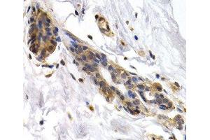 Immunohistochemistry of paraffin-embedded Human normal breast using PKLR Polyclonal Antibody at dilution of 1:200 (40x lens). (PKLR antibody)
