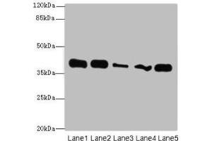 Western blot All lanes: KHDRBS2 antibody at 7 μg/mL Lane 1: K562 whole cell lysate Lane 2: Hela whole cell lysate Lane 3: A431 whole cell lysate Lane 4: Jurkat whole cell lysate Lane 5: NIH/3T3 whole cell lysate Secondary Goat polyclonal to rabbit IgG at 1/10000 dilution Predicted band size: 39 kDa Observed band size: 39 kDa (KHDRBS2 antibody  (AA 1-349))