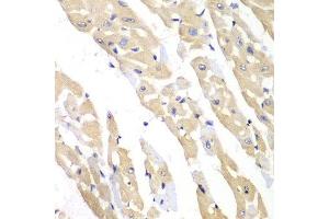 Immunohistochemistry of paraffin-embedded mouse heart using CCT3 antibody at dilution of 1:100 (x40 lens). (CCT3 antibody)