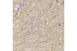 Immunohistochemistry of paraffin-embedded mouse brain using KCND3 antibody. (KCND3 antibody  (AA 502-636))