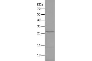 Western Blotting (WB) image for Neurofilament, Light Polypeptide (NEFL) (AA 318-543) protein (His tag) (ABIN7283252) (NEFL Protein (AA 318-543) (His tag))