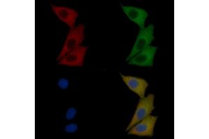 c-Kit Mouse Monoclonal Antibody staining Hela cells by IF/ICC.