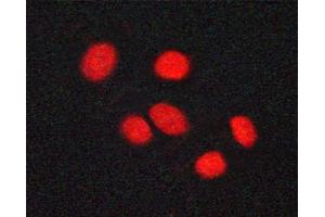 ABIN6267371 staining A549 cells by ICC/IF. (Vitamin D Receptor antibody  (pSer208))
