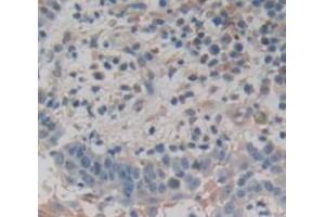 Figure. (Dermokine antibody  (AA 27-238))