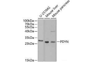 Western blot analysis of extracts of various cell lines using PDYN Polyclonal Antibody at dilution of 1:1000. (PDYN antibody)