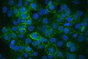 IF analysis of Integrin alpha 3 using anti-Integrin alpha 3 antibody (ABIN6719410). (ITGA3 antibody)