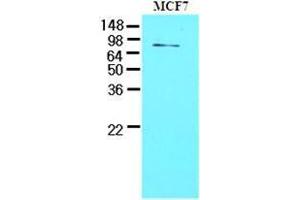 Cell lysates of MCF7 (30 ug) were resolved by SDS-PAGE, transferred to nitrocellulose membrane and probed with anti-human TDP1 (1:1000). (TDP1 antibody  (AA 1-298))