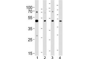Western blot analysis of lysate from 1) A431, 2) K562, 3) CEM cell line and 4) rat brain tissue using SUV39H2 antibody at 1:1000. (SUV39H2 antibody  (AA 360-390))