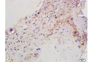 Formalin-fixed and paraffin embedded human placenta labeled with Rabbit Anti CYP19/CYP19A1 Polyclonal Antibody, Unconjugated (ABIN674529) at 1:200 followed by conjugation to the secondary antibody and DAB staining