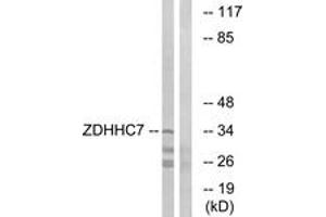 Western Blotting (WB) image for anti-Zinc Finger, DHHC-Type Containing 7 (ZDHHC7) (AA 259-308) antibody (ABIN2890485) (ZDHHC7 antibody  (AA 259-308))