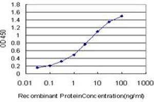 Detection limit for recombinant GST tagged PALM2 is approximately 0. (Paralemmin 2 antibody  (AA 321-411))