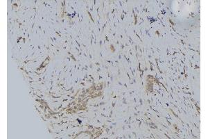 ABIN6274652 at 1/100 staining Human lung tissue by IHC-P. (CYP2S1 antibody  (Internal Region))
