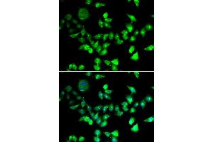 Immunofluorescence analysis of U2OS cells using SMC1A antibody. (SMC1A antibody)