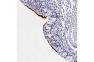 Immunohistochemical staining of human bronchus with C1orf114 polyclonal antibody  shows strong membranous positivity in respiratory epithelial cells.