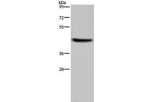 Western Blot analysis of Human adrenal gland tissue using HSD3B1 Polyclonal Antibody at dilution of 1:250 (HSD3B1 antibody)