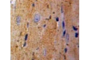 #VALUE! (TPT1 antibody  (AA 1-172))