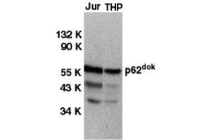 Western Blotting (WB) image for anti-Docking Protein 1, 62kDa (Downstream of tyrosine Kinase 1) (DOK1) (C-Term) antibody (ABIN1030364) (DOK1 antibody  (C-Term))