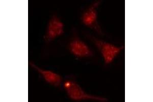 ABIN6277732 staining  HuvEc cells by IF/ICC. (NRF2 antibody  (pSer40))