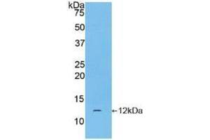 Detection of Recombinant CGa, Human using Polyclonal Antibody to Chorionic Gonadotropin Alpha Polypeptide (CGa) (CGA antibody  (AA 25-116))