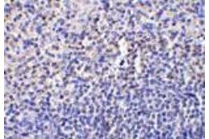 Immunohistochemistry of caspase-1 in human spleen tissue with caspase-1 antibody at 10 μg/ml. (Caspase 1 antibody  (Intermediate Domain))