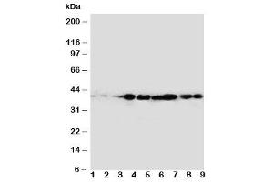 Western blot testing of CrkL antibody and rat samples 1: spleen (CrkL antibody  (AA 286-303))