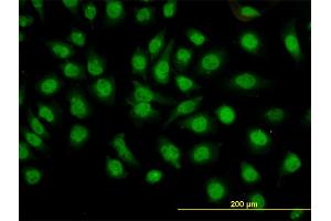 Immunofluorescence of monoclonal antibody to GMEB1 on HeLa cell. (GMEB1 antibody  (AA 467-563))