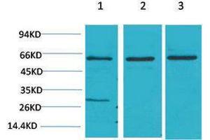 Western Blotting (WB) image for anti-V-Akt Murine Thymoma Viral Oncogene Homolog 2 (AKT2) antibody (ABIN3181588) (AKT2 antibody)