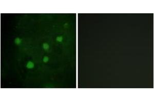 Immunofluorescence analysis of HuvEc cells, using BAF250B Antibody. (ARID1B antibody  (AA 1371-1420))