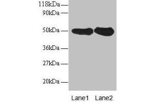 Western blot All lanes: RPN1 antibody at 2 μg/mL Lane 1: EC109 whole cell lysate Lane 2: 293T whole cell lysate Secondary Goat polyclonal to rabbit IgG at 1/15000 dilution Predicted band size: 50 kDa Observed band size: 50 kDa (RPN1 antibody  (AA 44-427))
